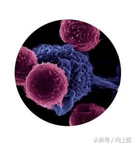 自身免疫性疾病的最新疗法,自身免疫性疾病吃什么药