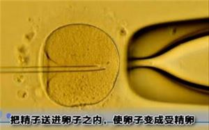 人工授精遭罪还是试管婴儿遭罪,试管婴儿的全部流程图解大全