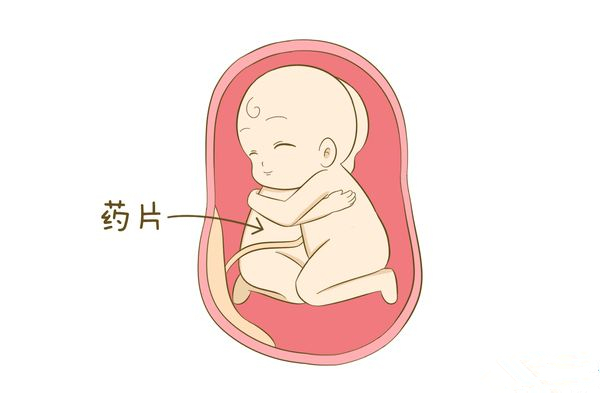 预产期40周到了,宝宝还没发动,继续等待还是催产?