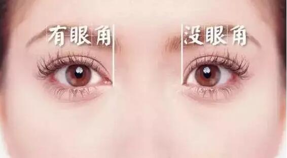 双眼皮原来这么简单自然无痕,做过的双眼皮如何看起来自然一些