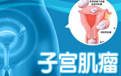 如果有子宫肌瘤一般有哪些表现,得子宫肌瘤的症状有哪些