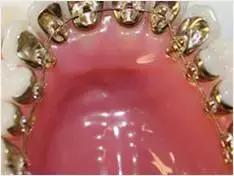 牙缝大漏财有什么说法,牙齿牙缝太宽会漏财吗