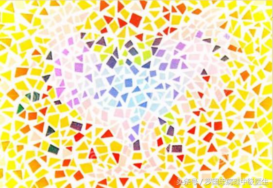 有方法纠正色盲色弱吗,色盲色弱测试诀窍讲解