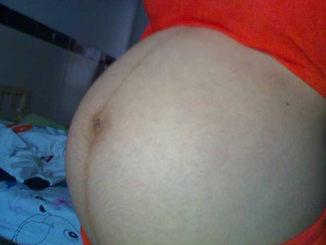 剖腹产后怀孕怎样预防粘连,剖腹产以后子宫粘连影响怀孕么