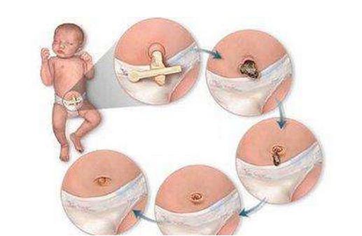 新手妈妈导致婴儿死亡事件,新手妈妈带娃出现的意外