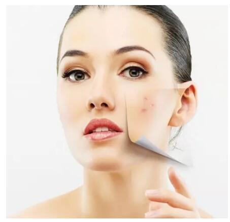 身体皮肤过敏后干燥起皮怎么修复,脸过敏干燥起皮紧绷发红怎么修复