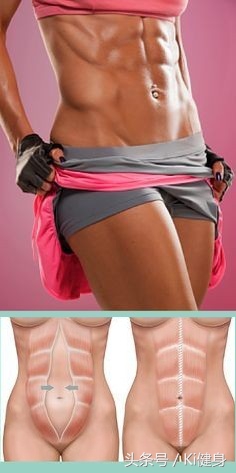 腹直肌上部分离,产后腹直肌分离