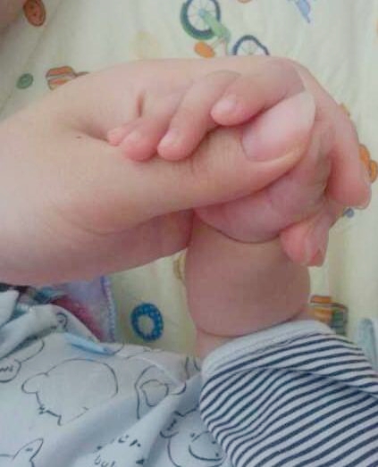 宝宝的拇指内扣怎么回事,宝宝三个半月大拇指内扣怎么办