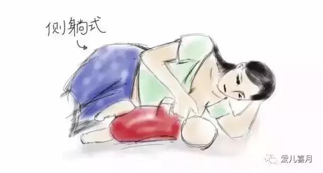 如何画剖腹产,什么是剖腹产手绘画