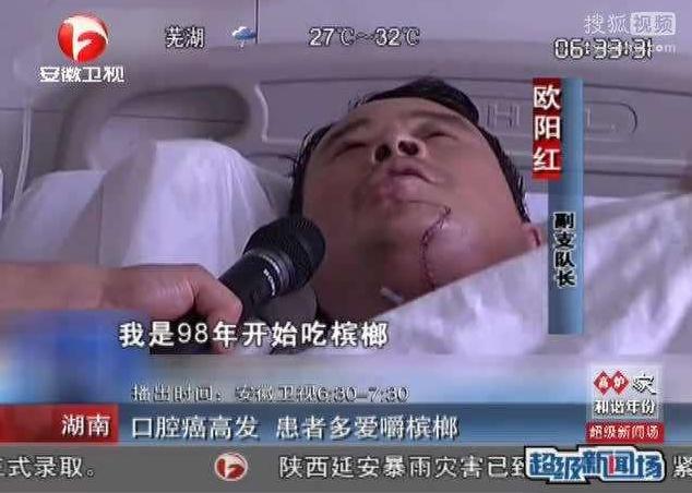 还需高度警惕口腔癌,口腔癌的真正罪魁祸首