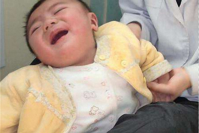 婴儿睡扁头的危害究竟有多大？矫正不及时会变傻子！