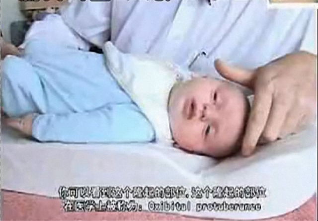 婴儿睡扁头的危害究竟有多大？矫正不及时会变傻子！