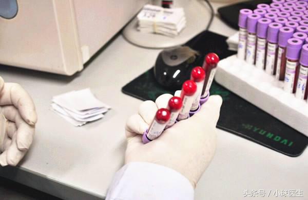 透析了,就不要再管肌酐高低了?!