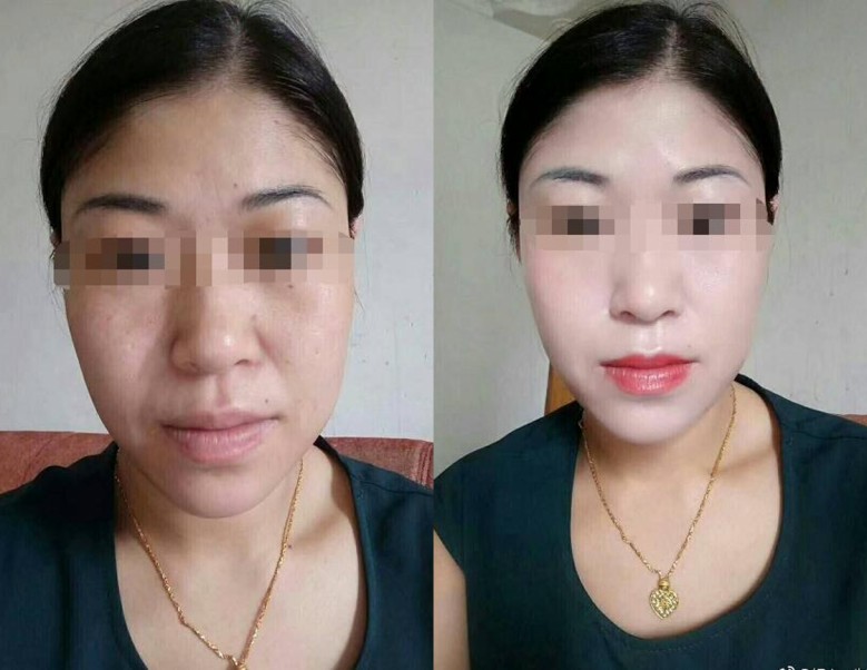 从邓伦刚代言的微商说起，谢娜关晓彤马伊琍朱茵都曾为微商代过言