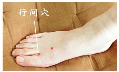 烧个开水也会没命？别让高血压匆匆带走你的生命