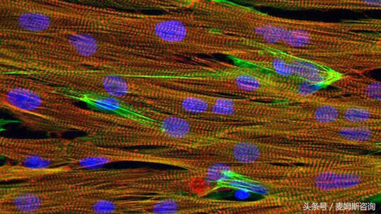 器官芯片技术,器官芯片