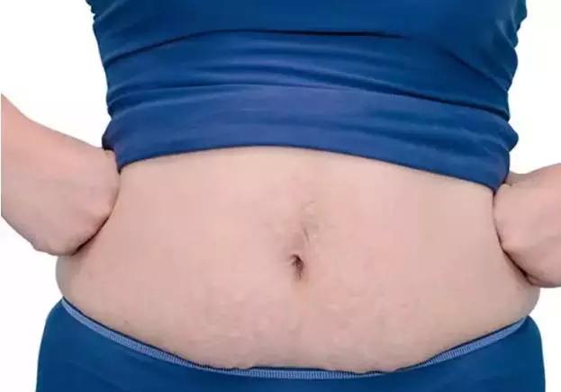 剖腹产后妊娠纹痒痒怎么缓解,剖腹产后妊娠纹痒怎么回事