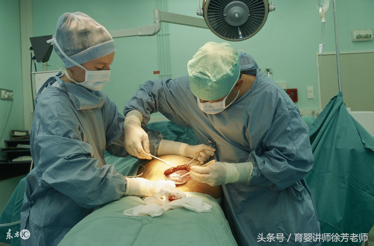 剖腹产后护理及注意事项有哪些,剖腹产产后怎样护理具体步骤