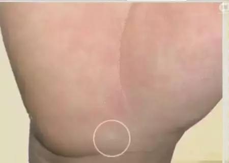 手的颜色能看出健康的问题吗,手是健康的镜子