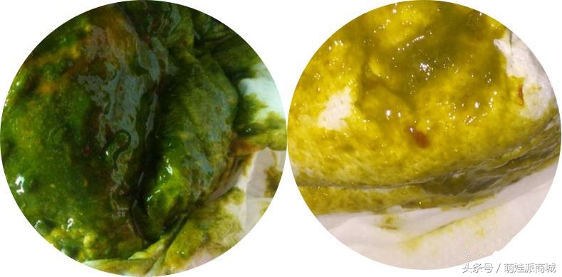 宝宝绿便的十种原因,12种绿便成因