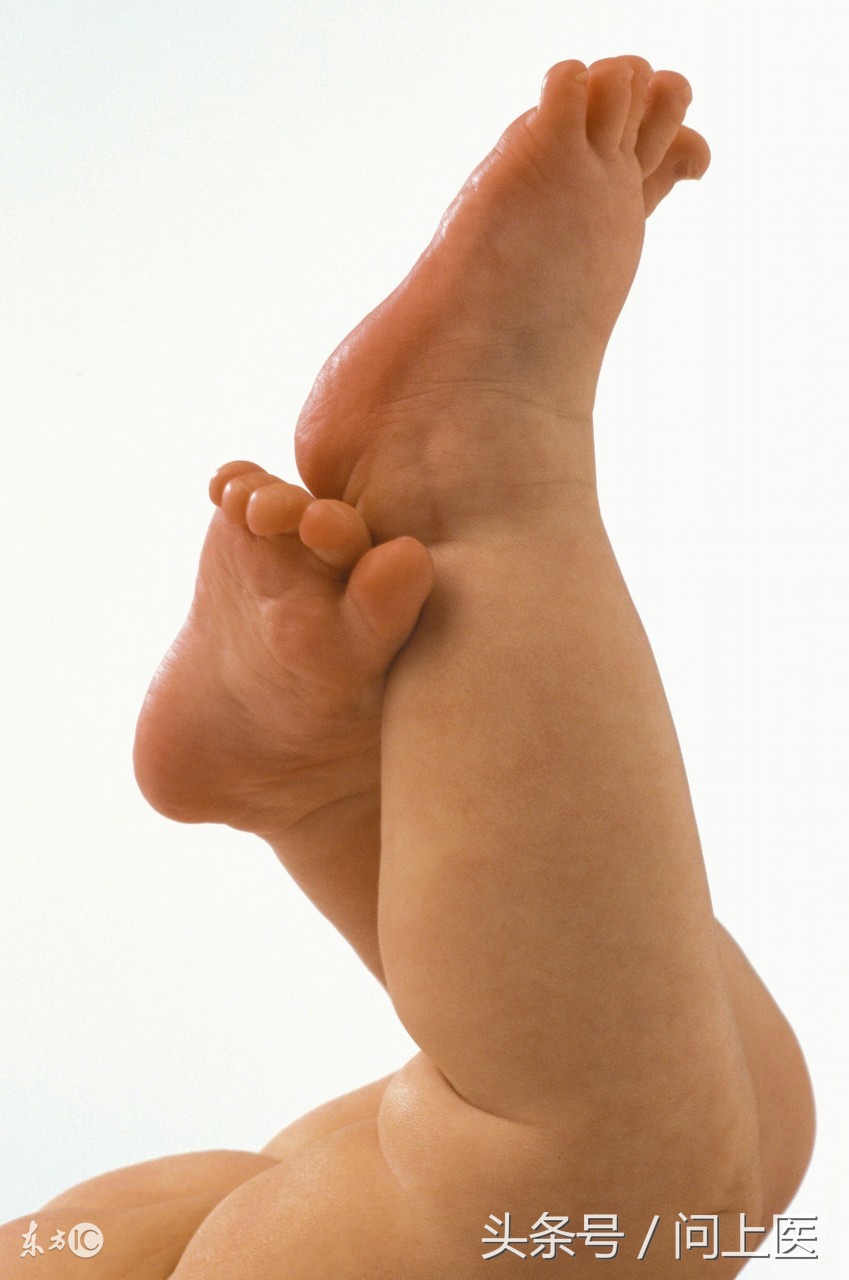 痛风不红也不肿但是痛得钻心,痛风发作了怎么才能快速缓解疼痛