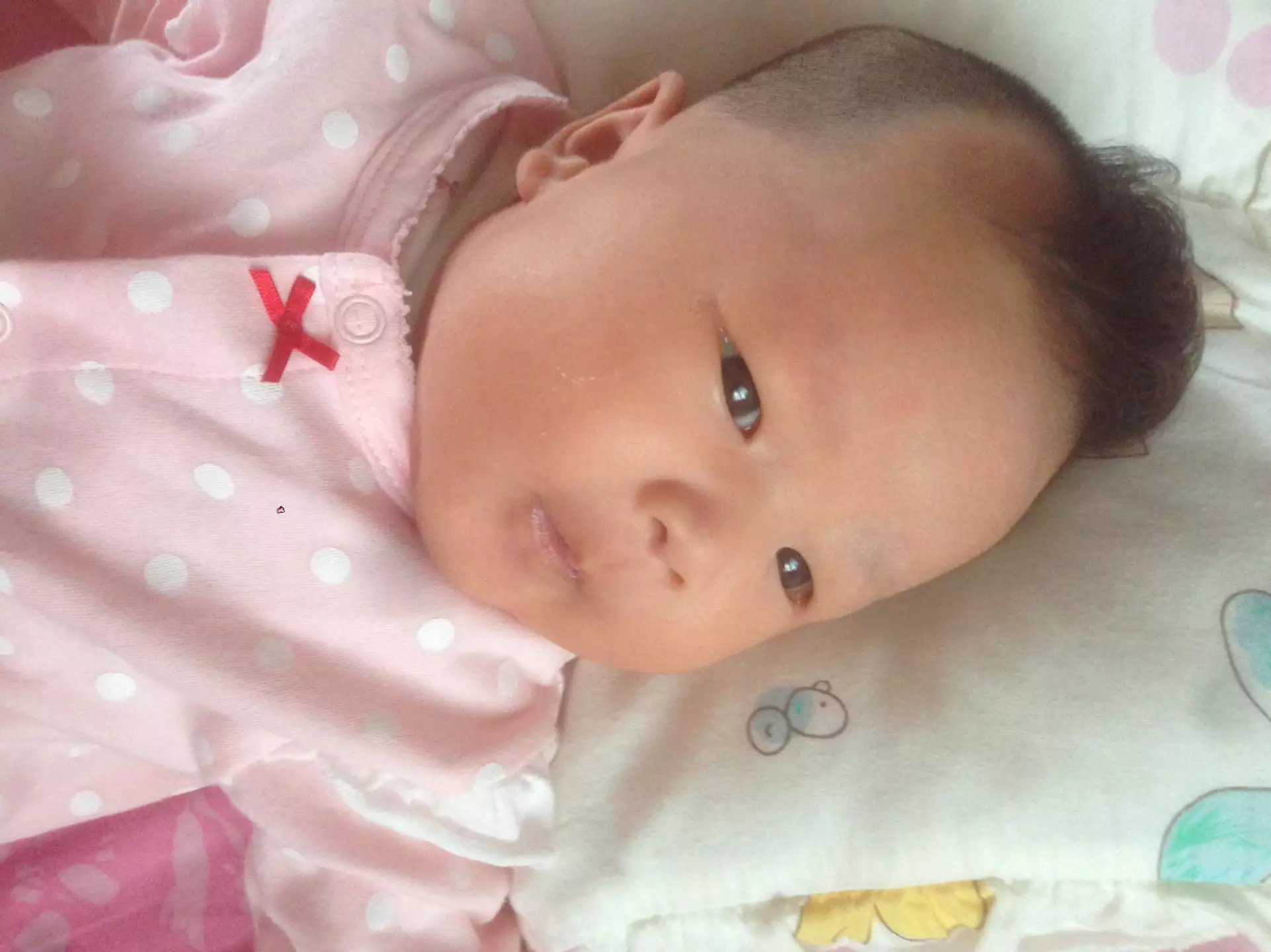 如何预防宝宝夏天长痱子,秋季痱子怎么快速消除