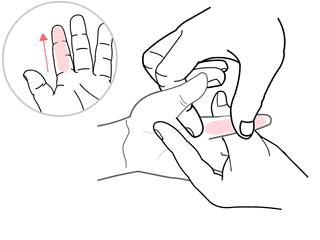 怎么判断宝宝咳嗽是肺热引起,宝宝肺热引起咳嗽怎么办