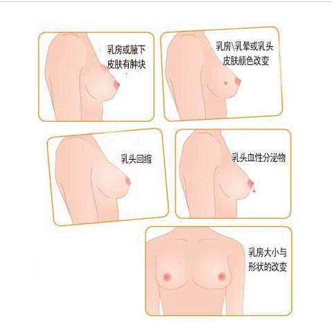 乳腺囊性增生吃中药调理有用吗,乳腺增生小叶增生怎么调理才能好