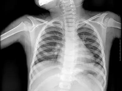 一起学看片儿：X光、CT、核磁，有啥区别？看完就懂了！