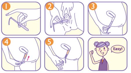 药用卫生巾真的可以防治妇科疾病？卫生棉条会破“处”？