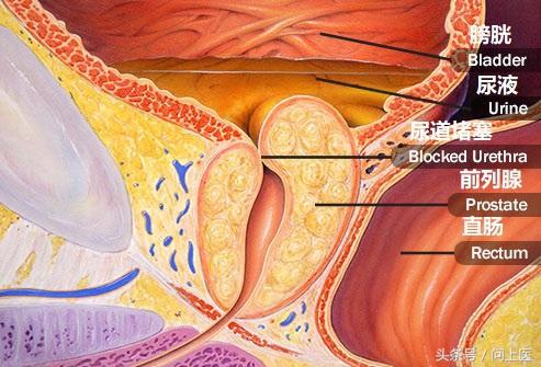 尿液哪个指标可以看出肾功能异常,尿液异常原因有哪些