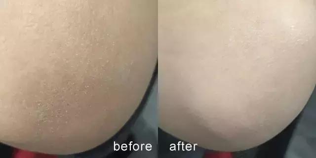 朋友圈摄影大家就要开始了，这5件必带神器你准备好了吗？