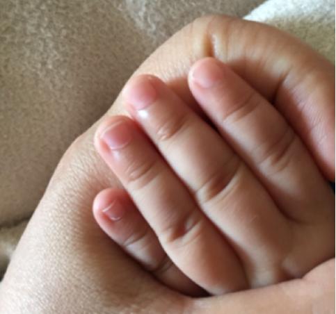 小月龄宝宝剪指甲甲沟炎,宝宝剪指甲出现甲沟炎怎么办