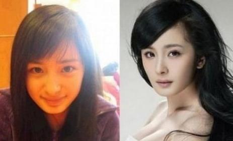 鼻子整形的方法有几种,鼻子整形方法都有哪些图片