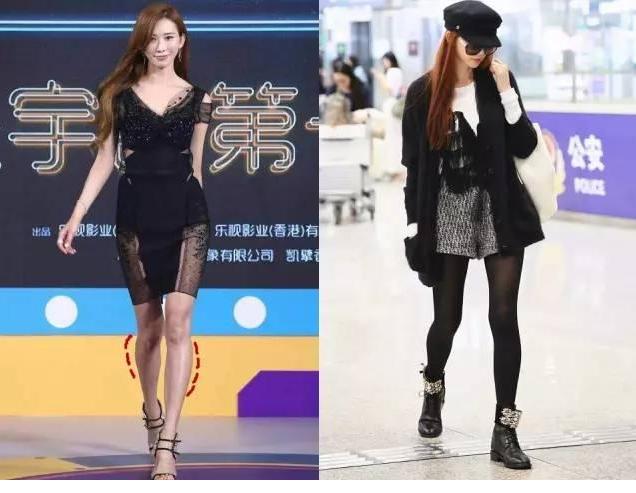 哪些动作导致小腿肌肉外翻,矫正小腿外翻的动作