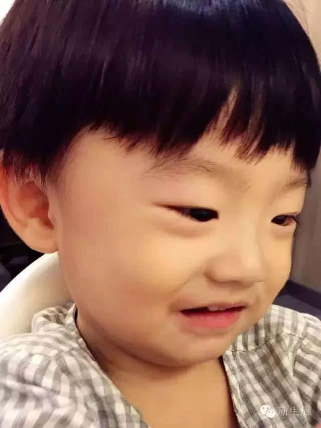 新生儿:婴儿皮肤起红疹?教你如何护理宝宝娇嫩的皮肤