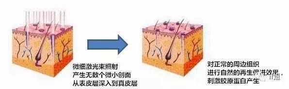 孙俪热巴皮肤,孙俪刘亦菲视频