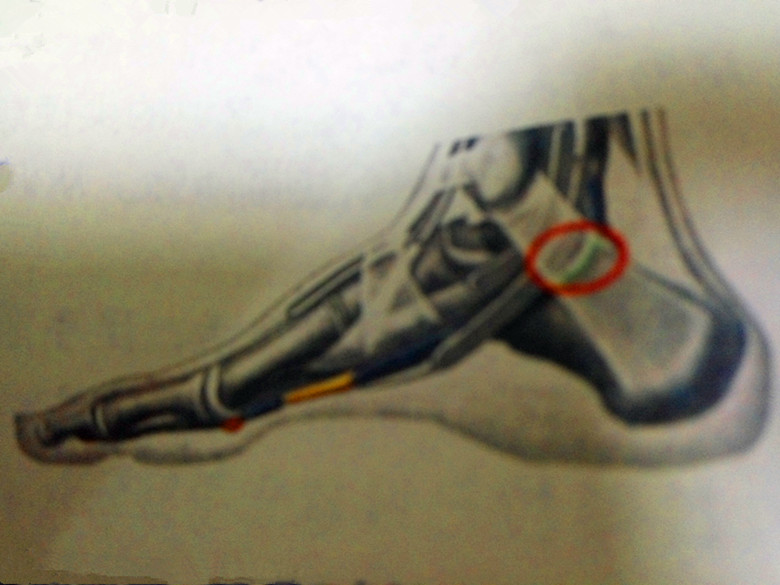 足部护理足跟痛,足跟痛足底穴位