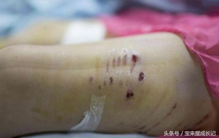 圣德育儿：孩子被狗攻击怎么办，是跑还是原地不动？赶紧教他自保