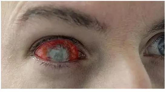 全世界奇葩美瞳,盘点那些奇葩美瞳