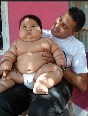 小孩肥胖的原因及减肥方法,儿童肥胖和超重减肥方法一样吗