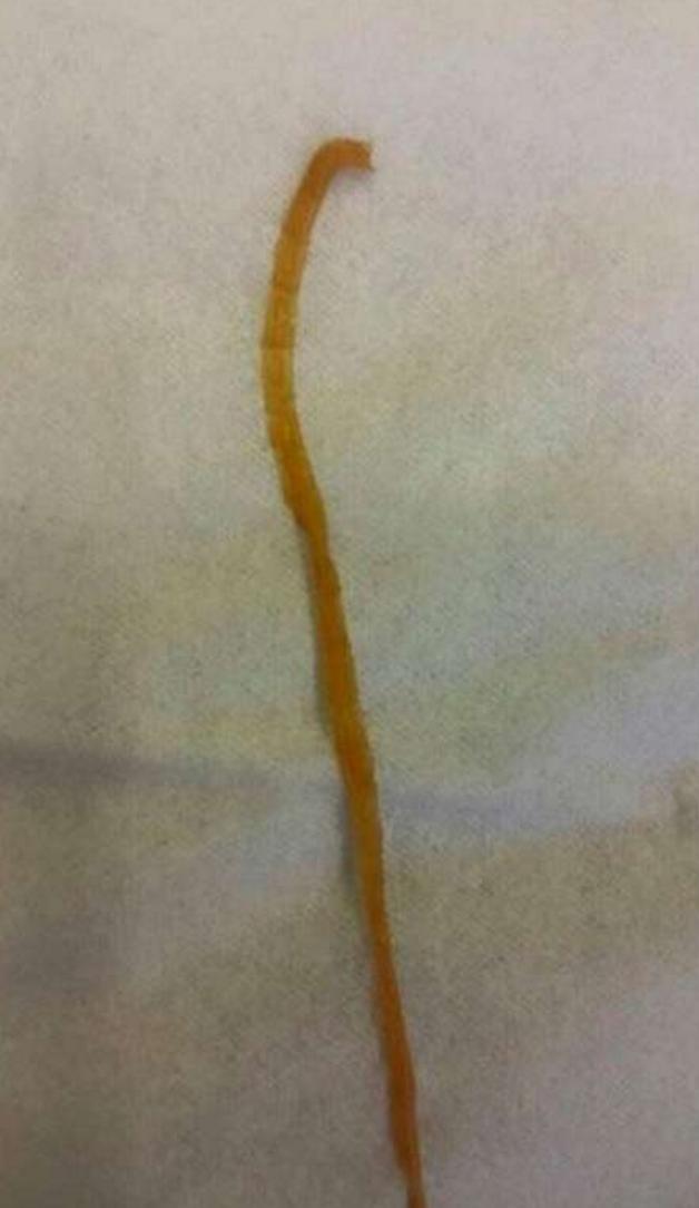 女士吃泻药腹泻不止,女生吃泻药突发腹泻