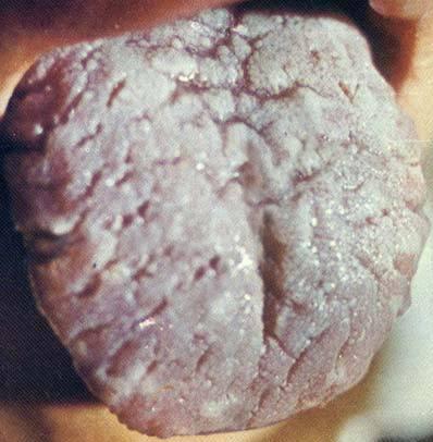 一些能够补锌又有营养的食物,精明妈妈补锌