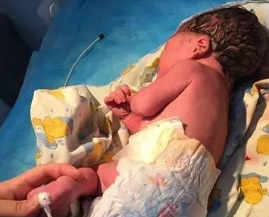 自然分娩最后分娩不出怎么办,生孩子到预产期没动静该怎么办