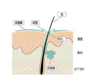 粉刺没有处理好变成硬疙瘩,痘痘粉刺消不掉