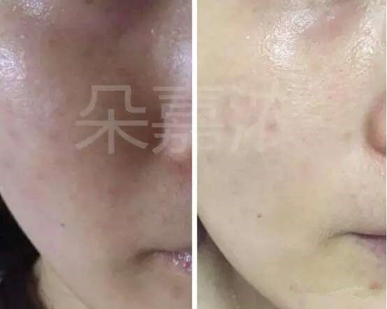 朵嘉浓能修复皮肤屏障吗,朵嘉浓肌肤屏障