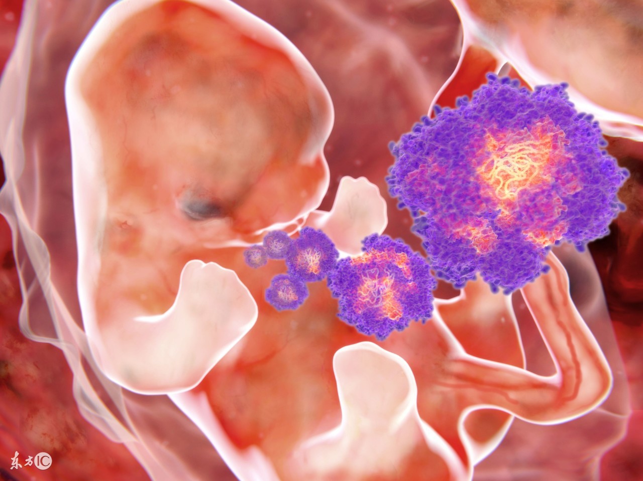 孕初期感冒吃退烧药对胎儿的影响,早孕孕妇发烧会不会把胎儿烧畸形