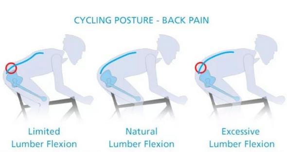 骑行的姿势不对会导致腰疼么,骑行颠簸腰疼怎么办
