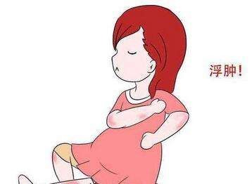 孕期下肢水肿很正常,孕期水肿右腿比左腿严重