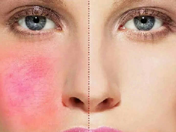 闈㈤儴鐜懓绮炬补鍙互娣℃枒娣＄棙鍗板悧,鐜懓绮炬补缇庣櫧鑴哥殑姝ｇ‘浣跨敤鏂规硶